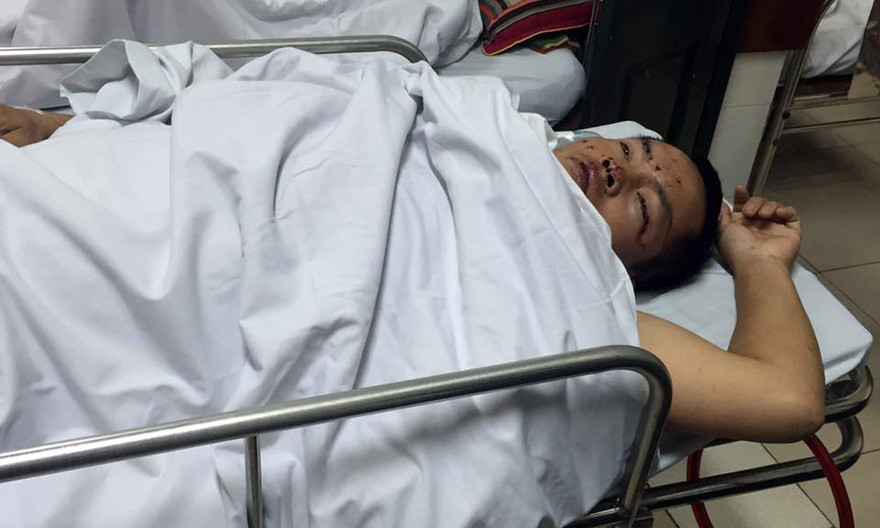 Anh Sơn đang được điều trị tại bệnh viện.