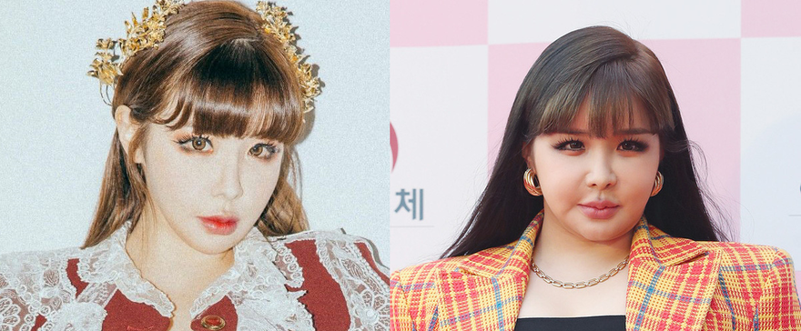 Vì sao Park Bom xinh tựa búp bê lại phát tướng khác lạ đáng sợ? 