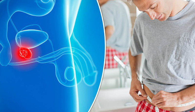 Làm thế nào phát hiện sớm ung thư tuyến tiền liệt?
