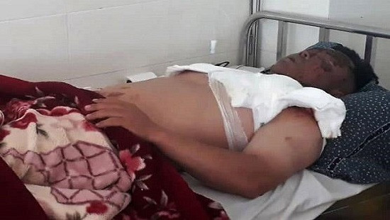 Nạn nhân Nguyễn Văn Giản. Ảnh: Internet