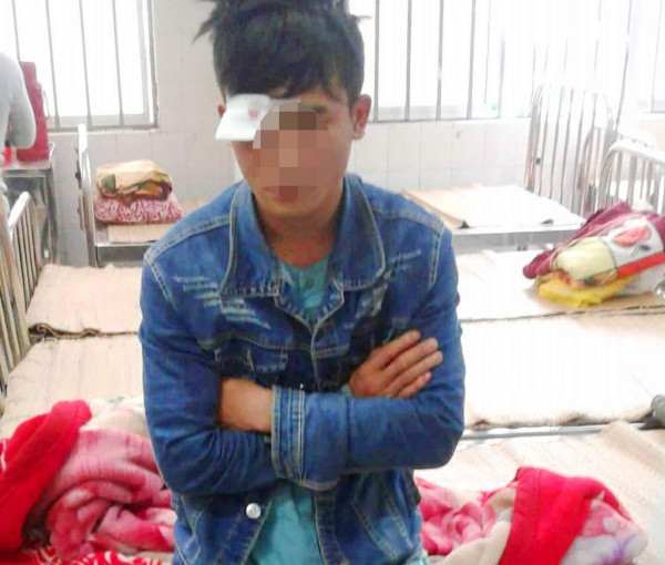 Anh T. với vết thương trên mắt 