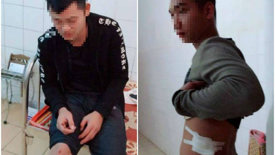 Lái và phụ xe khách Tú Hùng bị côn đồ bắn trọng thương