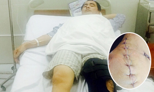 Nạn nhân bị các đối tượng côn đồn ngang nhiên truy sát giữa nơi phố phường đông người