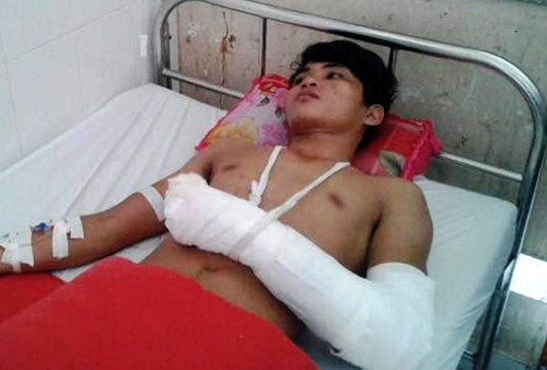 Anh Tình đang được điều trị. Ảnh: Phúc Hưng