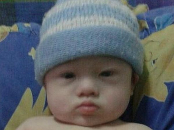 Bé Gammy đã bị bỏ lại với người mẹ người Thái Lan sau khi phát hiện bé mắc chứng Down. (Nguồn: dailytelegraph)