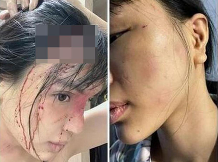 Hình ảnh thương tích của nạn nhân.