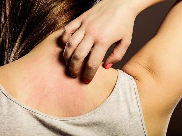 Ngứa hoài không dứt: Cảnh giác với 7 bệnh 'chết người'