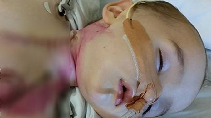 Em bé 8 tháng tuổi xấu số.