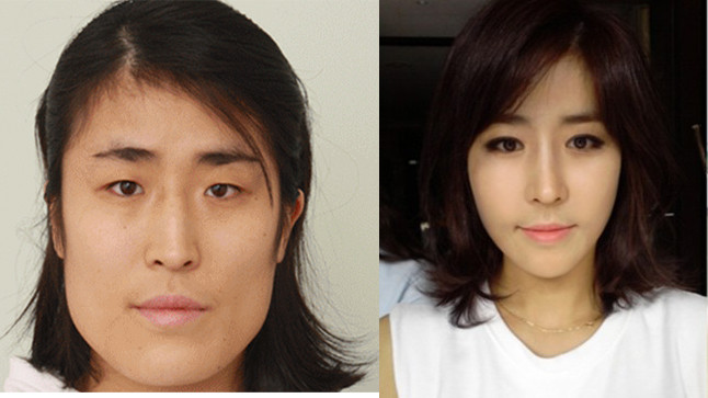 Dở khóc dở cười với các cô nàng 'vịt hóa thiên nga' sau thẩm mỹ