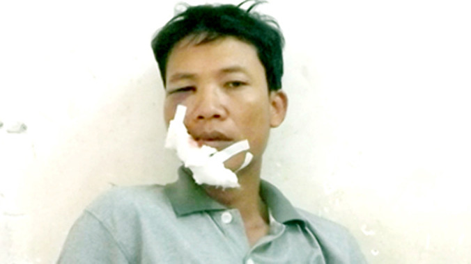 Anh Bằng kể lại tai nạn. Ảnh: Lê Huỳnh.