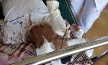 Ông Đố cấp cứu tại Bệnh viện Kinh Môn, Hải Dương trong tình trạng bị hàng chục vết thương