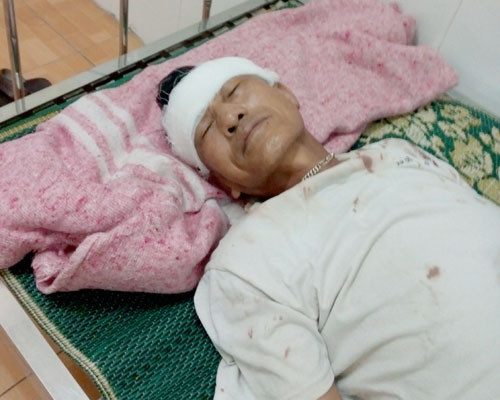 Ông Đố đang điều trị tại bệnh viện