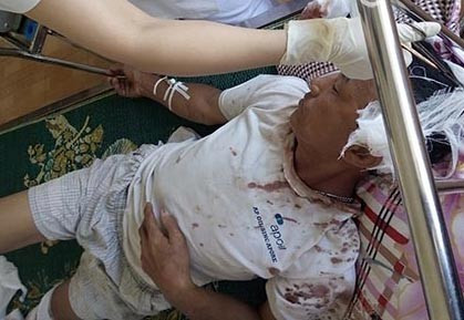 Ông Đố đang được cấp cứu tại Bệnh viện Đa khoa Kinh Môn. Ảnh: VTC