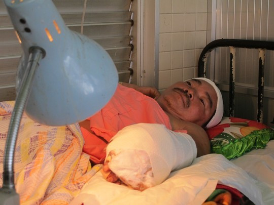 Các bác sĩ đã nối bàn tay cho ông Thảo