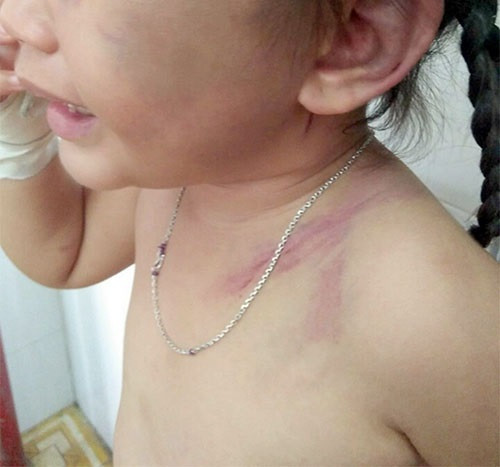 Gã cha dượng bất nhân đánh bé B. không thương tiếc. Ảnh: Báo Bình Thuận