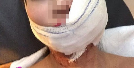 Ghen tuông bà chủ đã rạch mặt nữ nhân viên. Hình chỉ mang tính minh họa