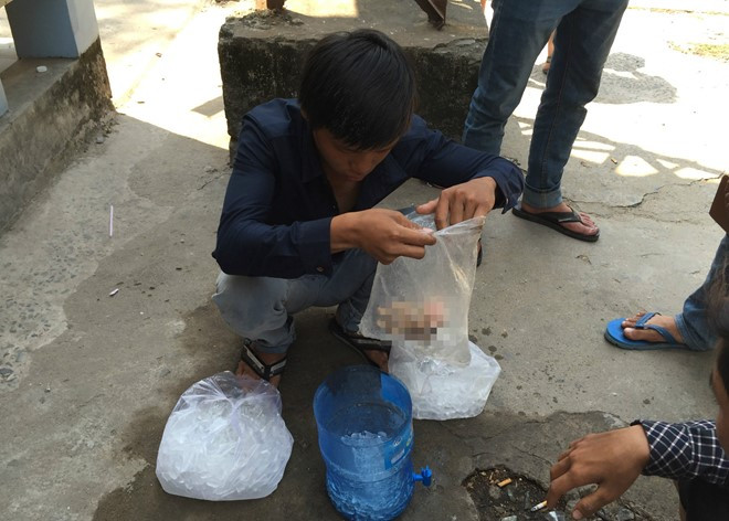 Anh của nạn nhân Phương đang ướp đá bàn tay bị đứt của em trai