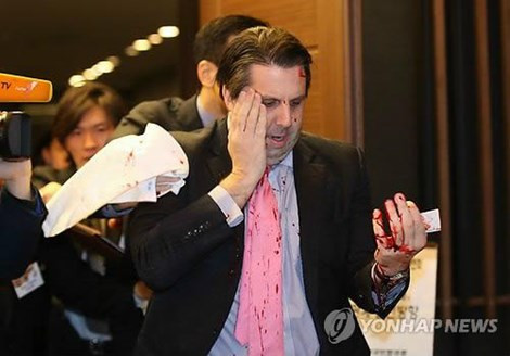 Ông Lippert bị thương chảy máu bên gò má phải (Ảnh: Yonhap News)
