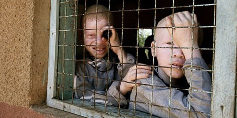  Người bạch tạng sống ở các trại tập trung để tránh bị tấn công