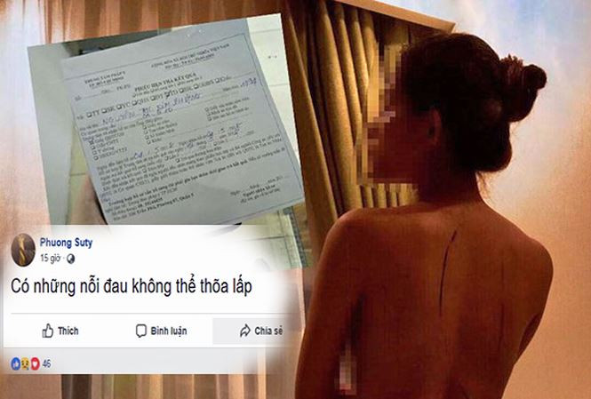  Động thái bất ngờ của mẫu khỏa thân