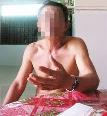 Ông Hiền, nhân vật chính của vụ việc (Ảnh: Vietnamnet)