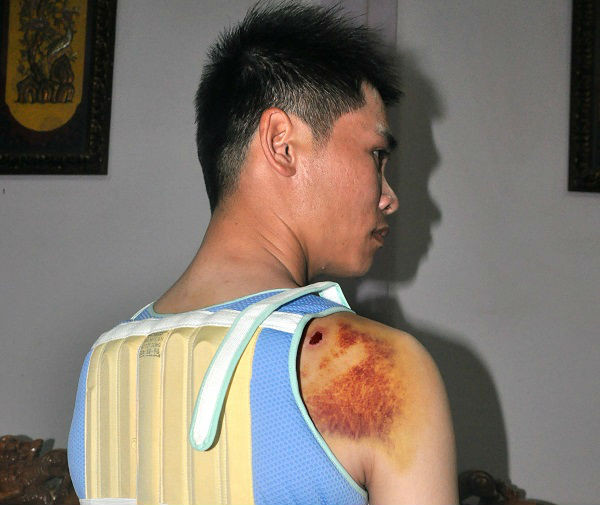 Anh Mậu bị con trai bí thư xã Nhân Cơ đánh