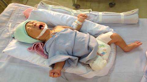 Sức khỏe sơ sinh văng khỏi bụng mẹ đang tiến triển tốt.