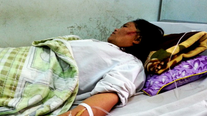 Chị Lê Thị Tâm phải khâu 10 mũi