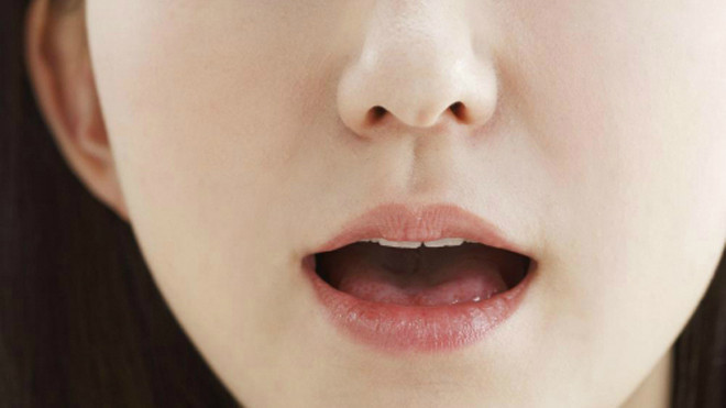 Ảnh minh họa: Wisegeek.com.