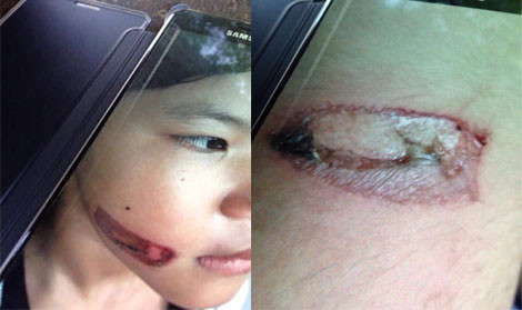 Hình ảnh do giáo viên nhà trường Vĩnh Thạnh chụp lại từ em T.