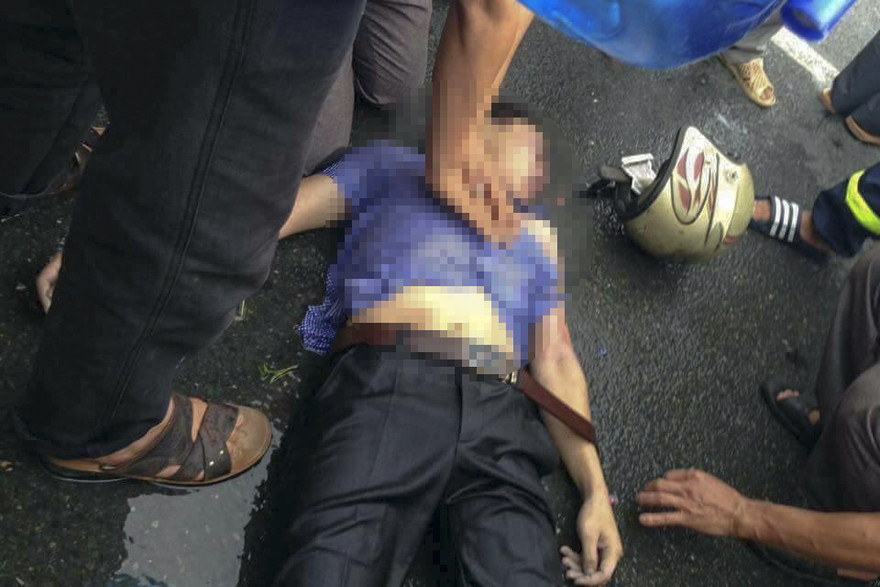 Anh T. đang được các bác sĩ tích cực cứu chữa để sớm bình phục. Ảnh: FB