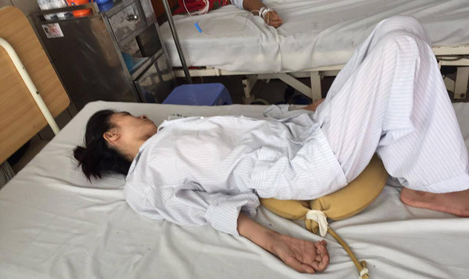 Liệt tứ chi, tổn thương thần kinh vì ngộ độc chì