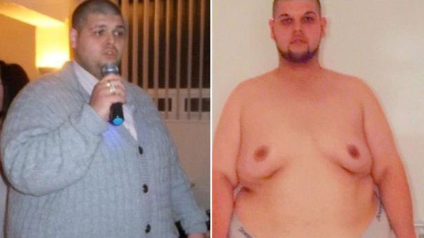 Gary nặng 205kg trước khi giảm cân.