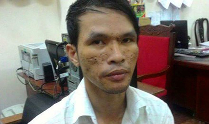 Nghi can Dũng tại cơ quan điều tra.