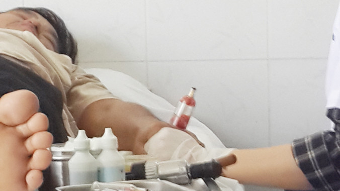 Không hút được thì “thầy” Đức dùng kim tiêm hút máu trực tiếp ra ống bơm. ảnh: H.D