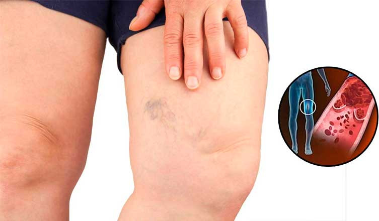 Ảnh minh họa: Authority Remedies 