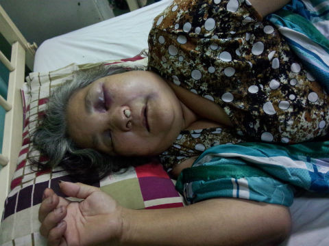 Bà Hoàng nằm bất tỉnh tại Bệnh viện Gia Định. 