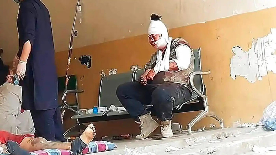 Một người Trung Quốc thiệt mạng trong vụ đánh bom xe buýt. (Ảnh: AP)