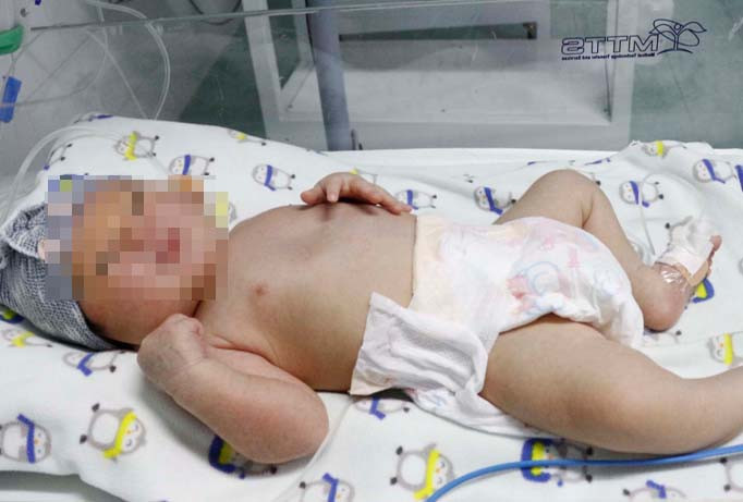 Bé sơ sinh đã tỉnh sau vài ngày điều trị.