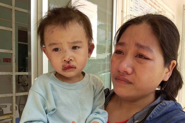 Bé gái thoát chết trong vụ sập nhà. Ảnh H.T