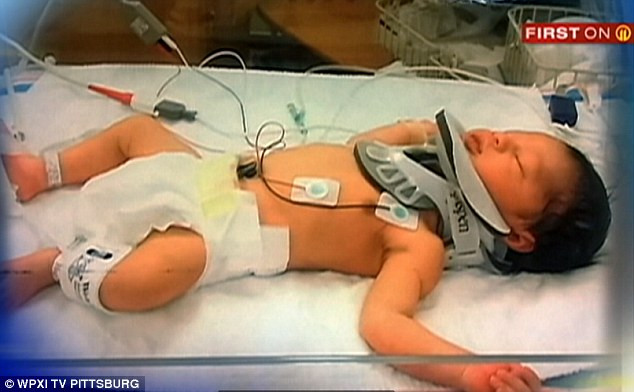 Bé sơ sinh chấn thương sọ não vì bị y tá đánh rơi