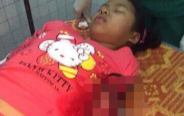 Em Hoàng Thị Duyên đang điều trị tại bệnh viện.