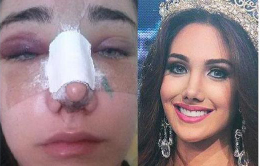 Tân Hoa hậu Quốc Tế 2015 bị tước vương miện?