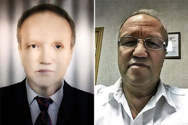 Kỳ lạ từ da trắng chuyển thành da đen sau khi ghép gan