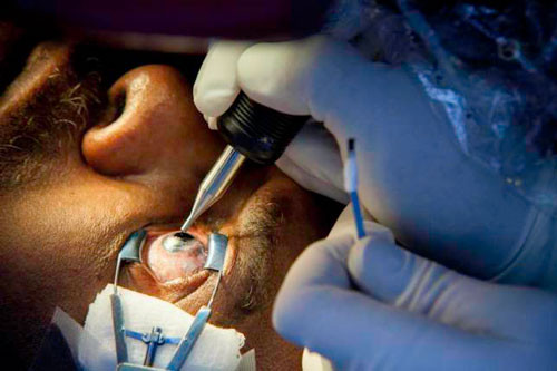 Quá trình nhuộm màu lòng trắng vô cùng đau đớn. 