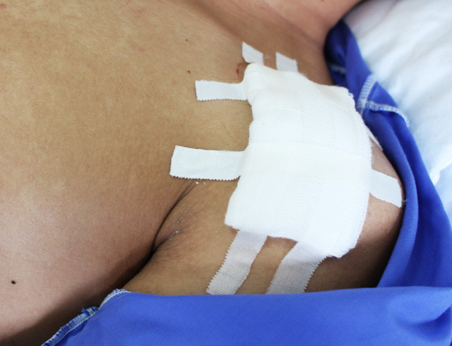 Em Vinh đang nằm ở bệnh viện sau khi bị đâm trọng thương