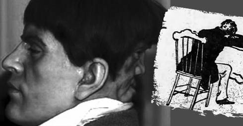 Hình ảnh được cho là của Edward Mordake kèm tranh minh họa trong cuốn Anomalies and Curiosities of Medicine. Ảnh: Hoaxes.