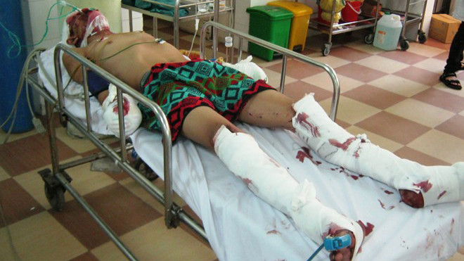 Anh Hảo là người bị thương nặng nhất. Tối 30/9 nạn nhân này đã được bác sĩ phẫu thuật, hiện vẫn đang nguy kịch