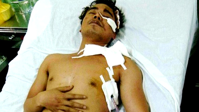 MC truyền hình bị cướp đâm trọng thương vào nửa đêm