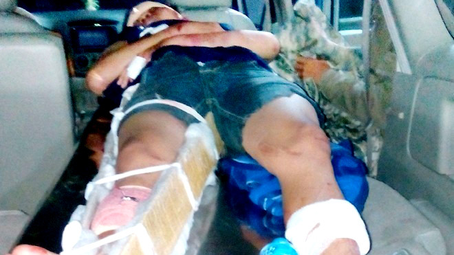 Anh Toàn bị gia đình người yêu bị 20% tỉ lệ thương tật